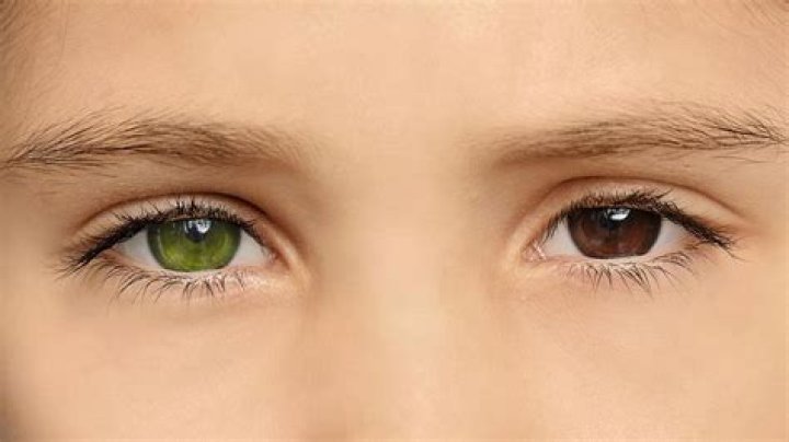 日本人のオッドアイとは？その原因・確率・有名人まで徹底解説